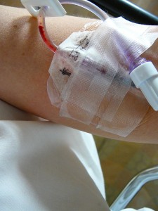 patient's arm prepped for iv drip